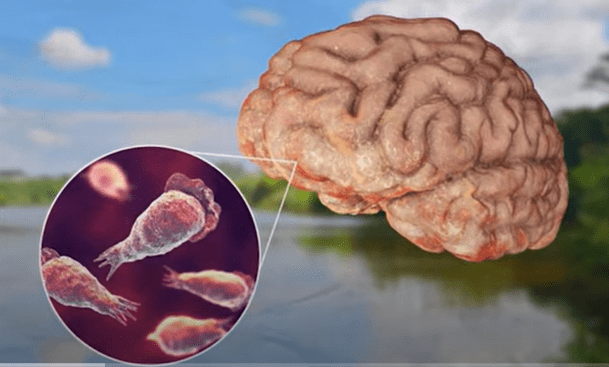 Microscopic view of Naegleria fowleri, the brain-eating amoeba causing rising infections in Kerala in 2025